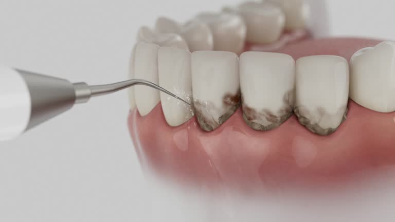 Reliable Teeth Cleaning And Checkup contractor in Iowa, IA by Dentist Open Now